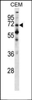 PPEF1 antibody