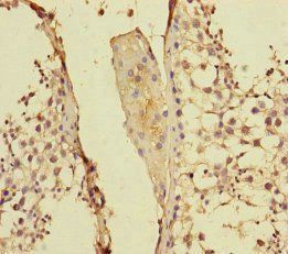 PPFIA1 Antibody