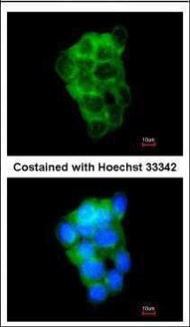 PPFIBP2 antibody