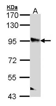 PPFIBP2 antibody