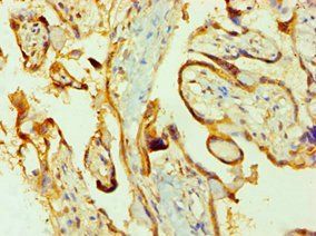 PPIB Antibody