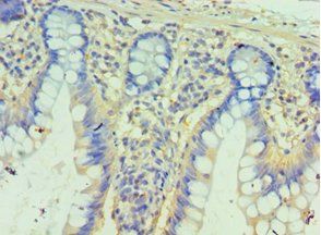 PPID Antibody