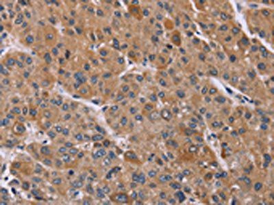 PPIF Antibody