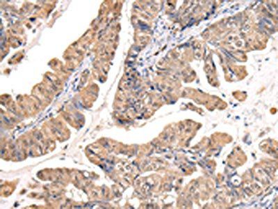 PPIL1 Antibody
