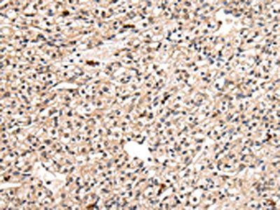 PPIL1 Antibody