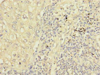 PPIL2 Antibody
