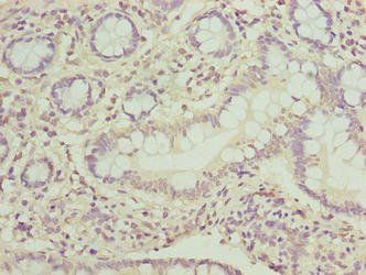 PPIL3 Antibody
