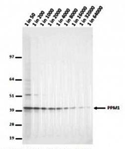 PPM1 (PP2A Methyltransferase) Monoclonal Antibody [4A4]