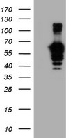 PPM1B Antibody