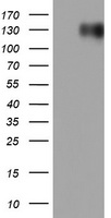 PPM1D antibody