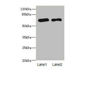 PPM1D antibody