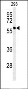 PPM1G antibody