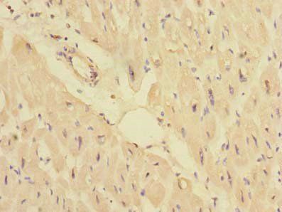 PPM1M Antibody