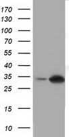 PPME1 Antibody