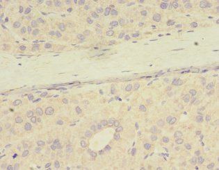 PPME1 Antibody