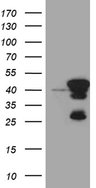 PPP1A (PPP1CA) antibody