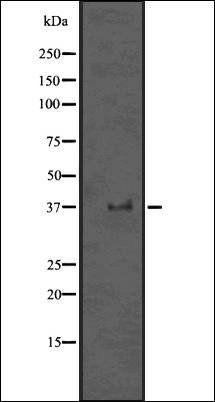 PPP1CA + 1CB antibody