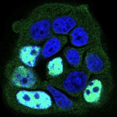 PPP1CB Antibody