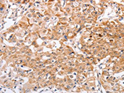 PPP1CB Antibody