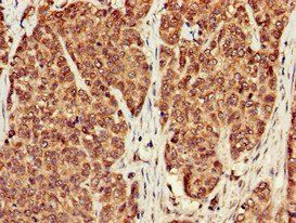 PPP1CB Antibody