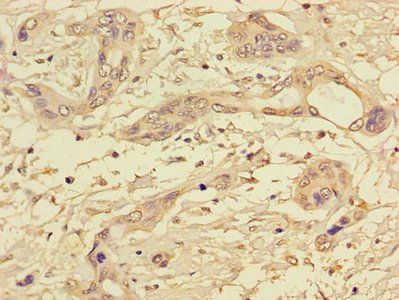 PPP1CC Antibody