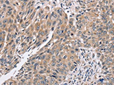 PPP1CC Antibody
