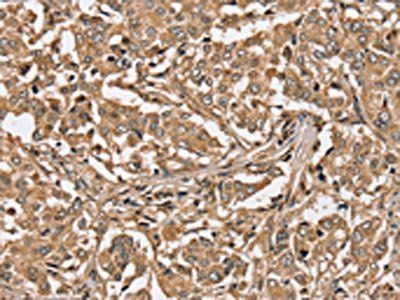 PPP1CC Antibody