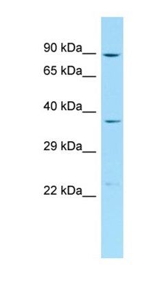 PPP1R12C antibody