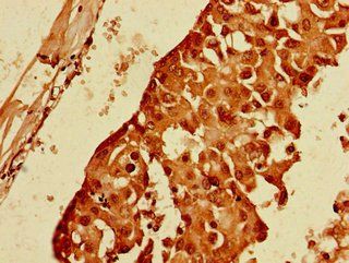 PPP1R13B Antibody