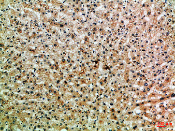 PPP1R13B Antibody