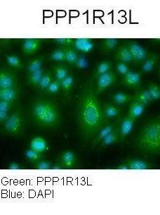PPP1R13L antibody