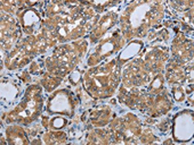 PPP1R13L Antibody