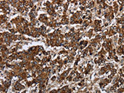 PPP1R13L Antibody