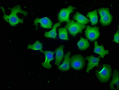 PPP1R13L Antibody
