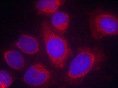 PPP1R14A (Ab-38) antibody