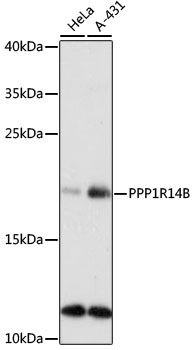 PPP1R14B antibody