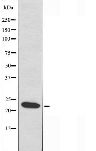 PPP1R14D antibody