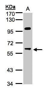 PPP1R16A antibody