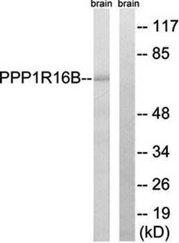 PPP1R16B antibody