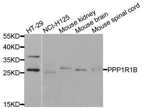 PPP1R1B antibody