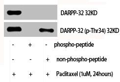 PPP1R1B antibody