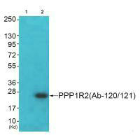 PPP1R2 (Ab-120/121) antibody