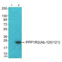 PPP1R2 (Ab-120/121) Antibody