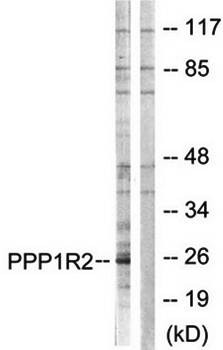 PPP1R2 antibody