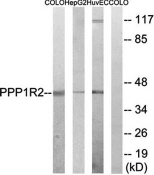 PPP1R2 antibody