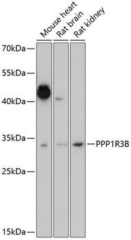 PPP1R3B antibody