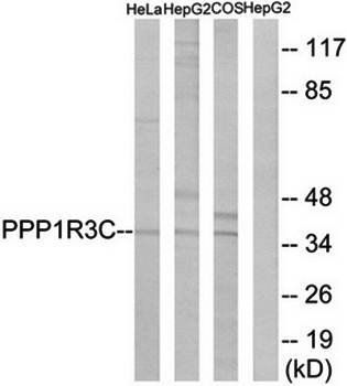 PPP1R3C antibody