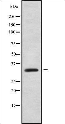 PPP1R3D antibody