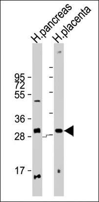 PPP1R3E antibody