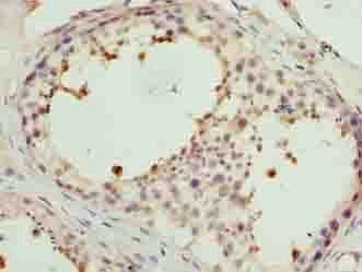 PPP1R7 Antibody